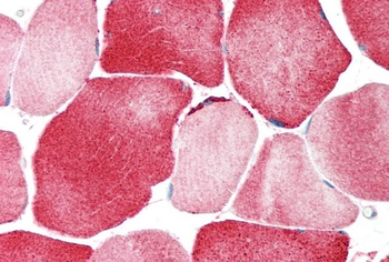 KCNJ12 Rabbit Polyclonal Antibody