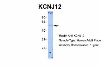KCNJ12 Rabbit Polyclonal Antibody