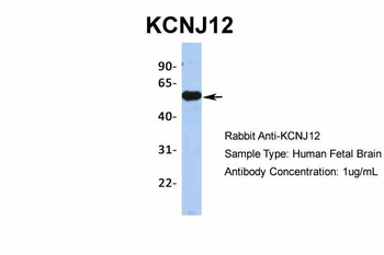 KCNJ12 Rabbit Polyclonal Antibody