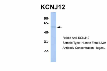KCNJ12 Rabbit Polyclonal Antibody