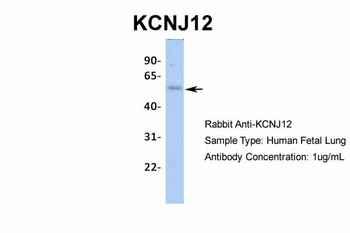 KCNJ12 Rabbit Polyclonal Antibody
