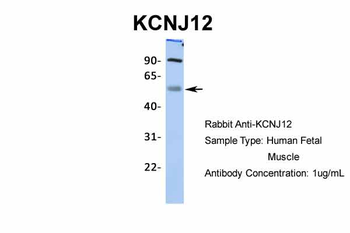 KCNJ12 Rabbit Polyclonal Antibody