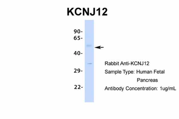 KCNJ12 Rabbit Polyclonal Antibody