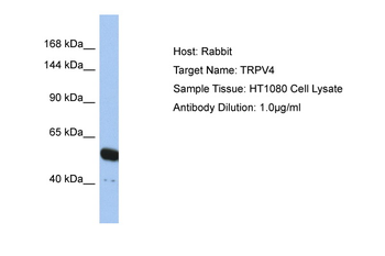 TRPV4 Rabbit Polyclonal Antibody