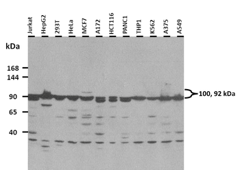 KCNH6 Rabbit Polyclonal Antibody