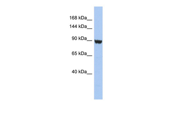 KCNH6 Rabbit Polyclonal Antibody