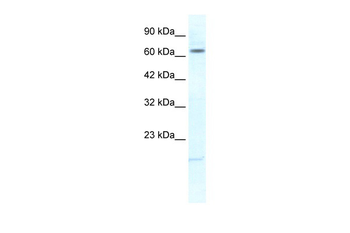 KCNH6 Rabbit Polyclonal Antibody