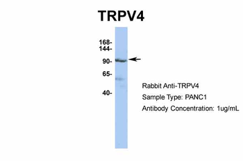 TRPV4 Rabbit Polyclonal Antibody