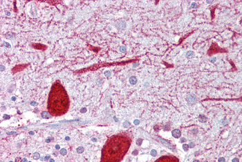 KCNQ2 Rabbit Polyclonal Antibody