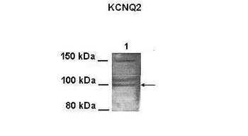 KCNQ2 Rabbit Polyclonal Antibody