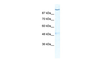 KCNH6 Rabbit Polyclonal Antibody