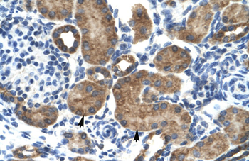 GRIK2 Rabbit Polyclonal Antibody