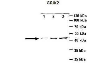 GRIK2 Rabbit Polyclonal Antibody