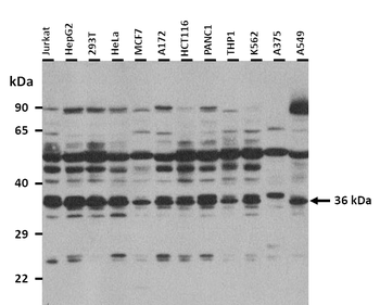 KCTD13 Rabbit Polyclonal Antibody