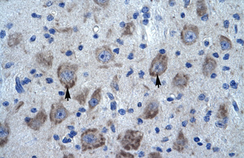 KCTD13 Rabbit Polyclonal Antibody