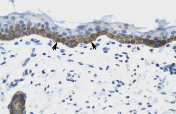 NUDT9 Rabbit Polyclonal Antibody