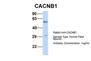 CACNB1 Rabbit Polyclonal Antibody