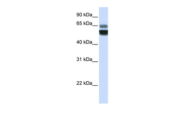 SMPD1 Rabbit Polyclonal Antibody
