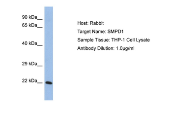 SMPD1 Rabbit Polyclonal Antibody