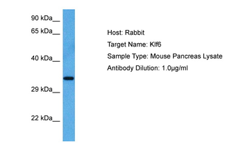 KLF6 Rabbit Polyclonal Antibody
