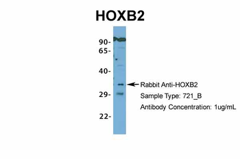 HOXB2 Rabbit Polyclonal Antibody