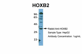 HOXB2 Rabbit Polyclonal Antibody