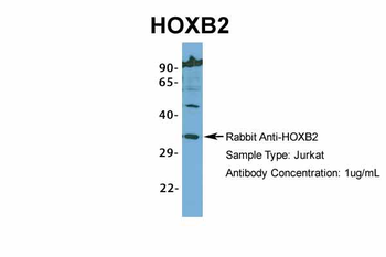 HOXB2 Rabbit Polyclonal Antibody