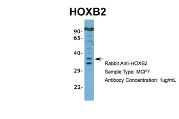HOXB2 Rabbit Polyclonal Antibody