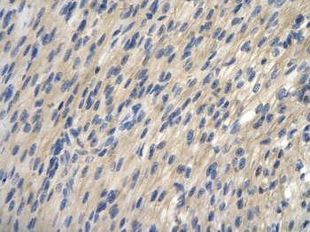 TRIP13 Rabbit Polyclonal Antibody