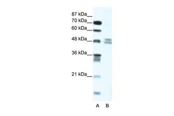 TRIP13 Rabbit Polyclonal Antibody