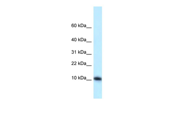 Med21 Rabbit Polyclonal Antibody