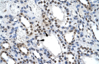 ILF2 Rabbit Polyclonal Antibody