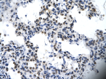 ILF2 Rabbit Polyclonal Antibody