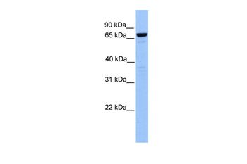 MTA2 Rabbit Polyclonal Antibody
