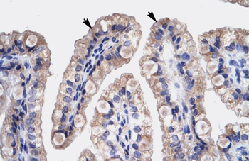HMGB3 Rabbit Polyclonal Antibody