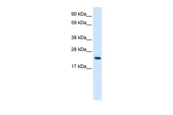 HMGB3 Rabbit Polyclonal Antibody
