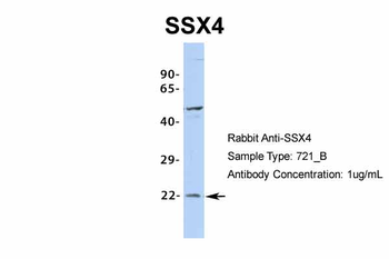 SSX4 Rabbit Polyclonal Antibody