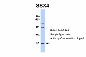 SSX4 Rabbit Polyclonal Antibody