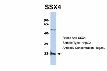 SSX4 Rabbit Polyclonal Antibody
