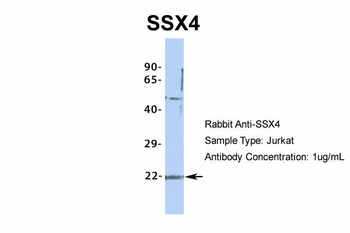 SSX4 Rabbit Polyclonal Antibody