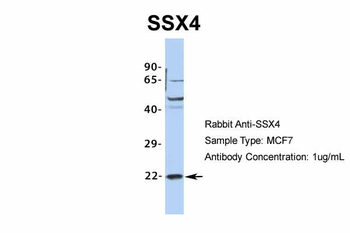 SSX4 Rabbit Polyclonal Antibody