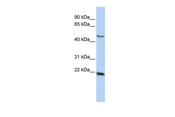 SSX4 Rabbit Polyclonal Antibody
