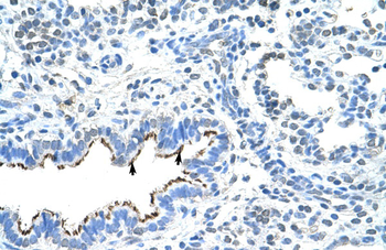 ZNF239 Rabbit Polyclonal Antibody