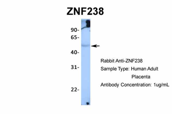 ZNF238 Rabbit Polyclonal Antibody