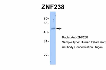 ZNF238 Rabbit Polyclonal Antibody