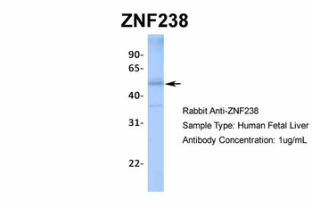 ZNF238 Rabbit Polyclonal Antibody