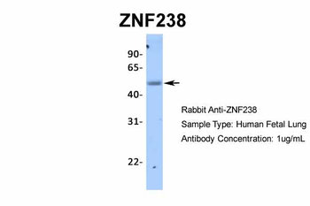 ZNF238 Rabbit Polyclonal Antibody