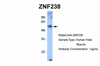 ZNF238 Rabbit Polyclonal Antibody