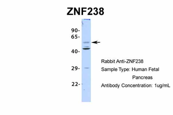 ZNF238 Rabbit Polyclonal Antibody