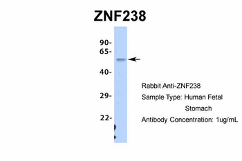 ZNF238 Rabbit Polyclonal Antibody